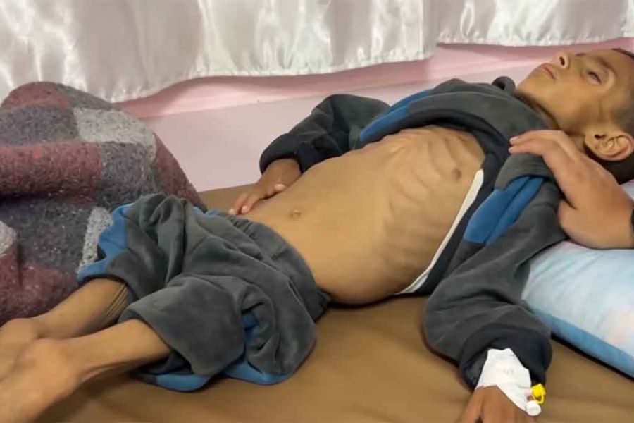 ارتفاع حصيلة وفيات التجويع بغزة إلى 251 شهيدًا 