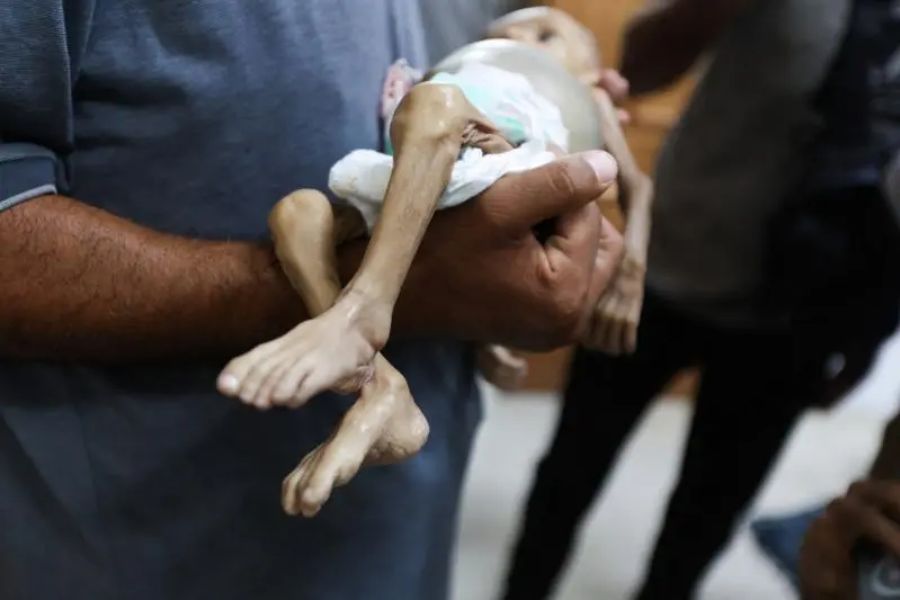 غوتيريش: مجاعة غزة من صنع الإنسان ولا بدَّ من العقاب
