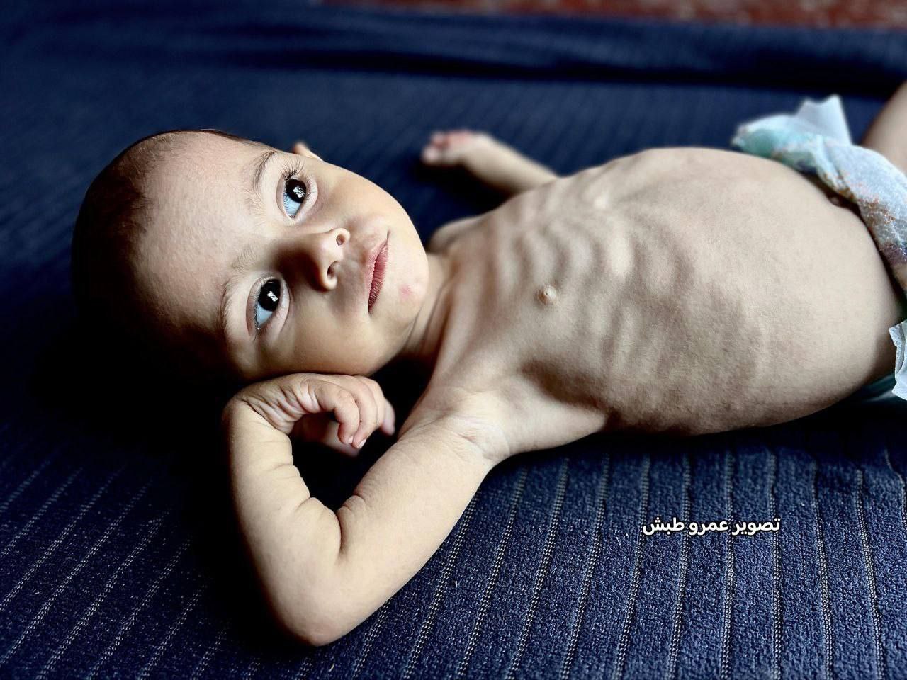 غزّة.. المجاعة تحصد أرواح المدنيين والأطفال و 52 شهيدًا خلال 24 ساعة