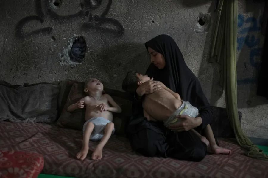 الاحتلال يتعمّد تجويع أكثر من 100 ألف طفل ومريض في غزة