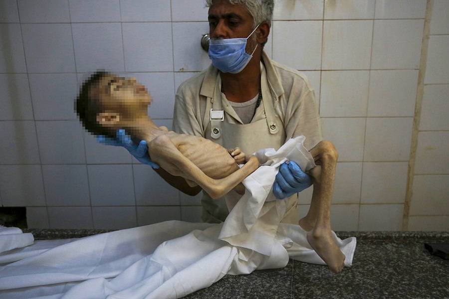 منظمة الصحة العالمية توثّق وفاة 421 إنسانًا بسوء التغذية في غزة خلال 2025