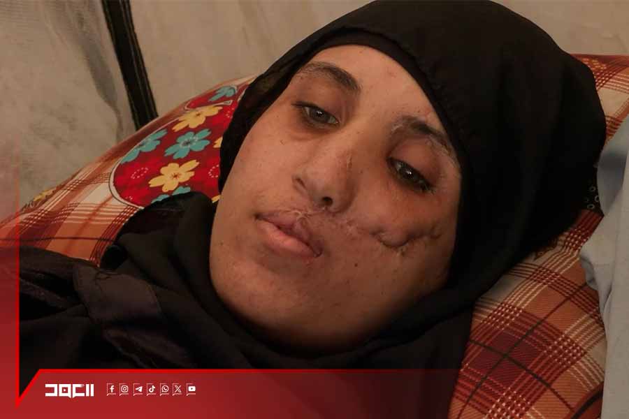 منى كحيل النازحة من غزة .. أمٌ أرملة جريحة مريضة وحامل