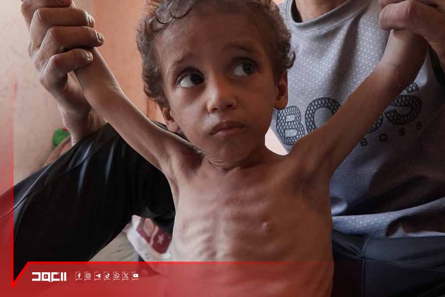 الطفل يزن ابو فول ينضم إلى لائحة 