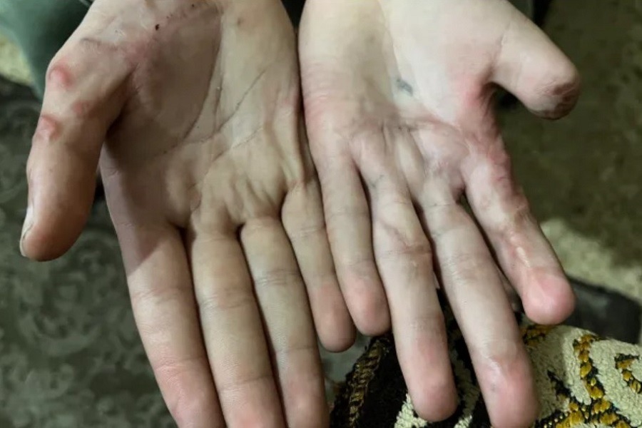 شهادات أطفال تعرضوا للاغتصاب والتعذيب على أيدي مجندات 