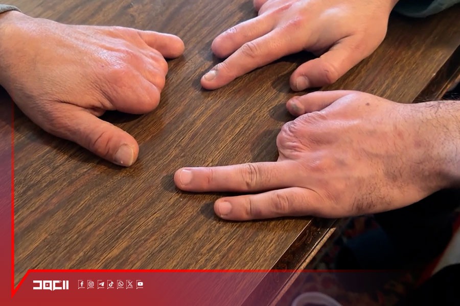 عوائل جرحى المقاومة الإسلامية تجدد تمسكها بخطها حتى تحرير الأرض وصون الكرامة