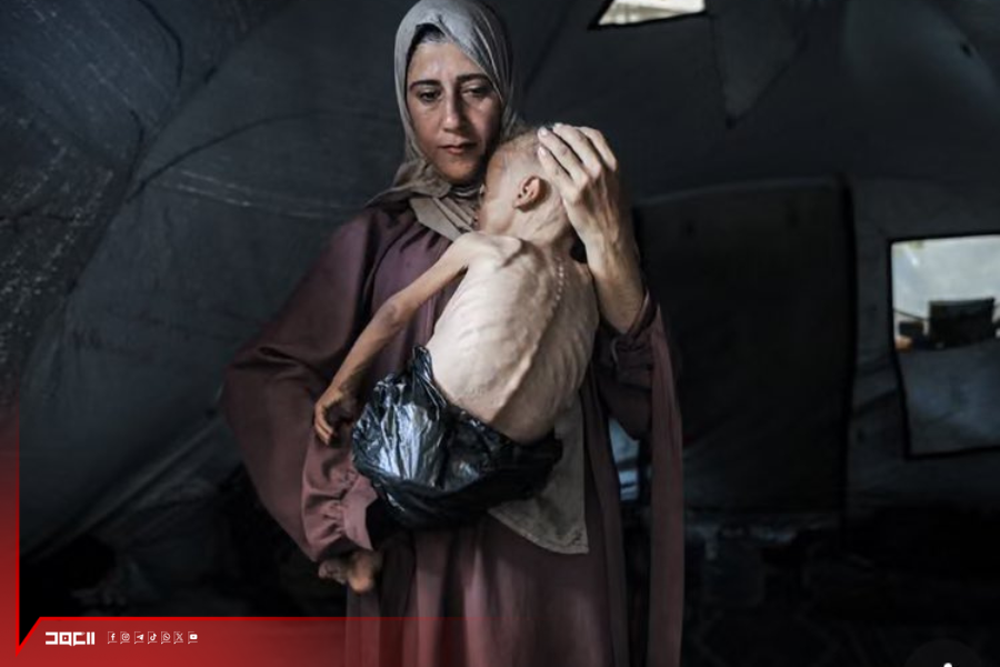 المجاعة في غزة: جريمة موثقة أمميًّا وسرديّة الإنكار تنهار