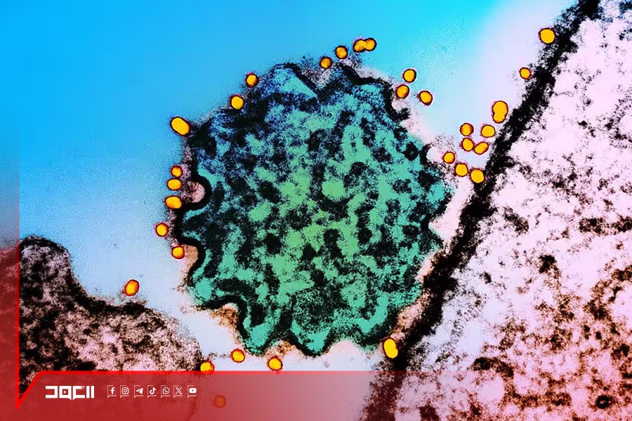 انتشر مؤخرًا.. ما هو فيروس نيباه؟