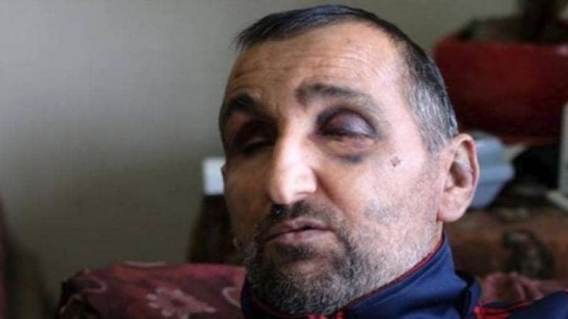 جنود الاحتلال يعتدون بالضرب المبرِّح على فلسطيني كفيف