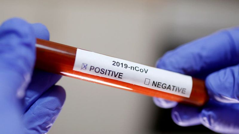 متى تنتفي الحاجة العلمية لفحوصات الـpcr؟