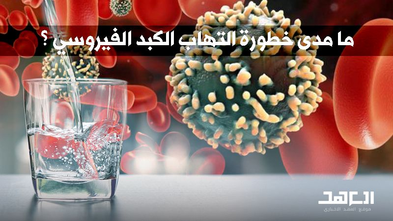 فيروس "Hepatite-A" في لبنان.. لا داعي للقلق والحماية بالنظافة