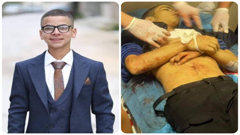 شهيد فلسطيني وأربعة جرحى خلال إقتحام الإحتلال لمقام يوسف بنابلس